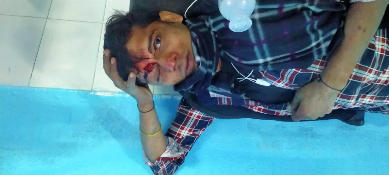 नशे की हालत में बुरी तरह जख्मी हुआ बाइक सवार शराबी युवक,थानाध्यक्ष को सूचना दिए जाने के बाद भी इलाजरत युवक पीएचसी से हुआ फरार,चर्चाओं का बाजार गर्म।।*