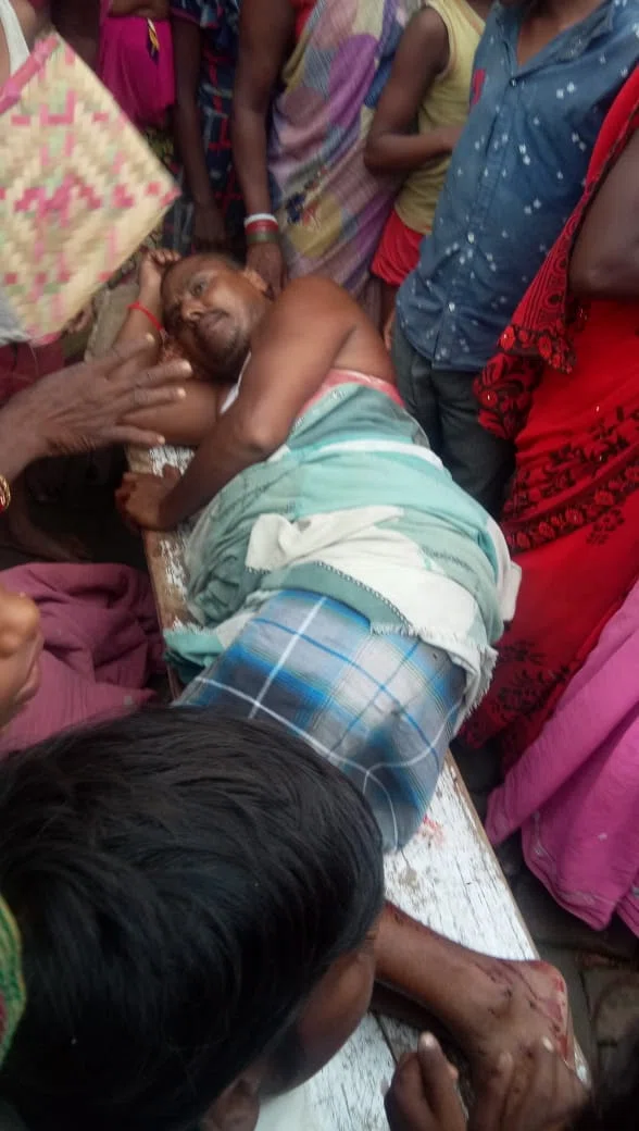बाइक सवार बदमाशों ने किशोर पोद्दार को गोली मारकर किया बुरी तरह जख्मी,पुरानी रंजिश को ले ताड़ी उतारकर घर जा रहे रामलखन पर भी धारदार हथियार से जानलेवा हमला,हालत गंभीर