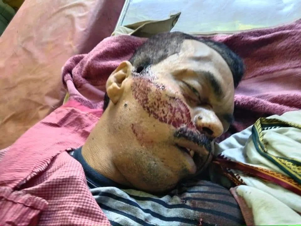 दारोगा सुरेन्द्र यादव ने सर्विस रिवाल्वर से गोली मारकर आखिर क्यों कर ली आत्महत्या?तफ्तीश में जुटी पुलिस
