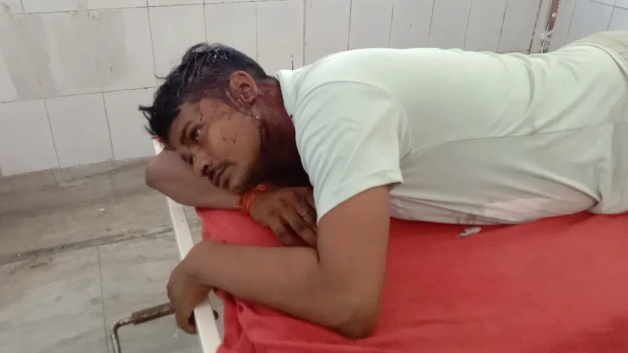 दो भाईयों के बीच हुई जमकर मारपीट,दोनों जख्मी भाईयों का इलाज जारी