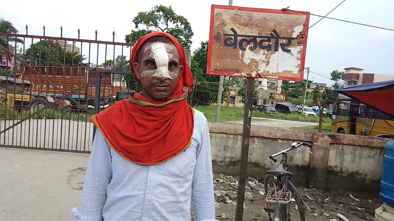 जमीनी विवाद को ले दबंगों ने युवक पर किया जानलेवा हमला,नाक का हड्डी भी तोड़ा,मामला दर्ज कर छानबीन में जुटी पुलिस