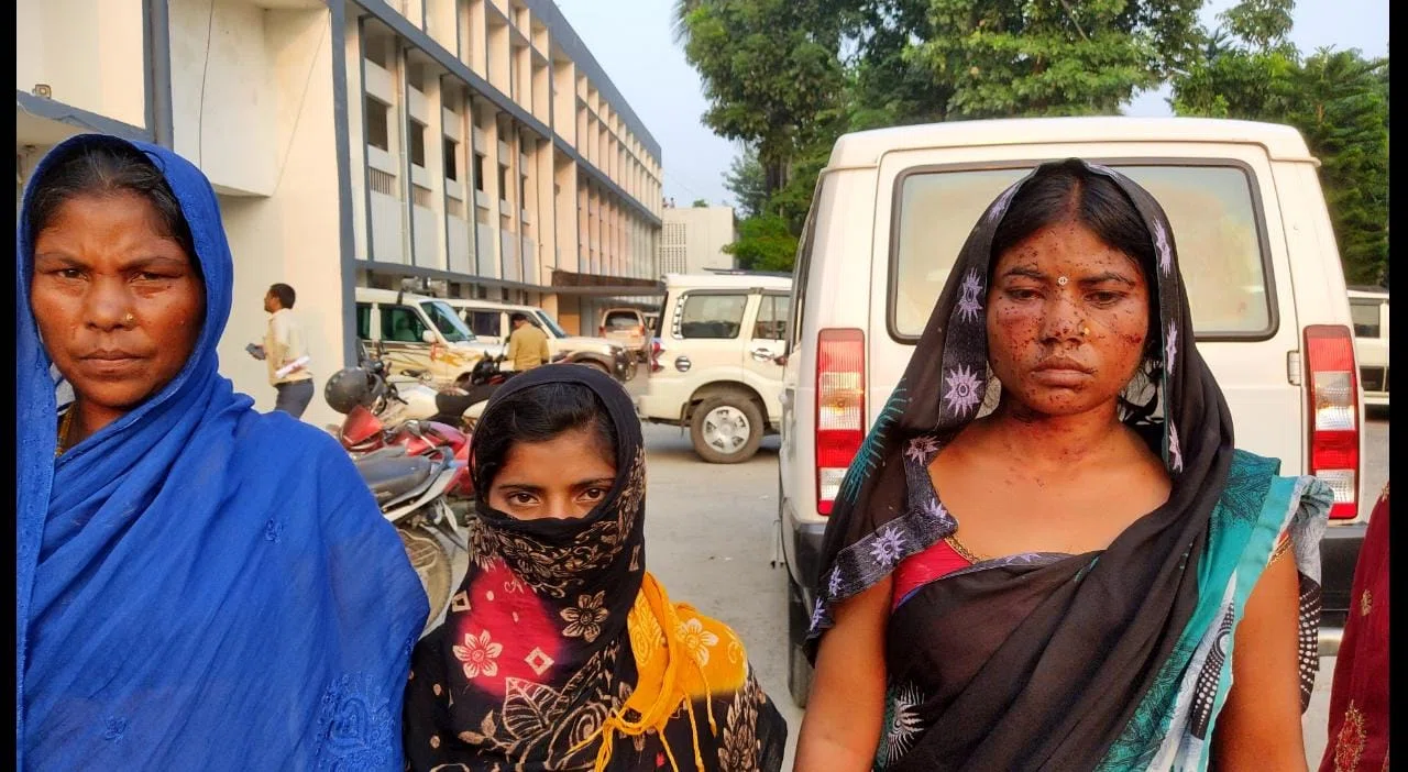 दरिंदे ने घर में घुसकर सुप्तावस्था में युवती को बनाना चाहा हवश का शिकार,शोर सुनकर पहुंची युवती की मां पर मनचले ने चला दी गोली,बाल-बाल बची महिला,लेकिन बारुद से झुलसा चेहरा