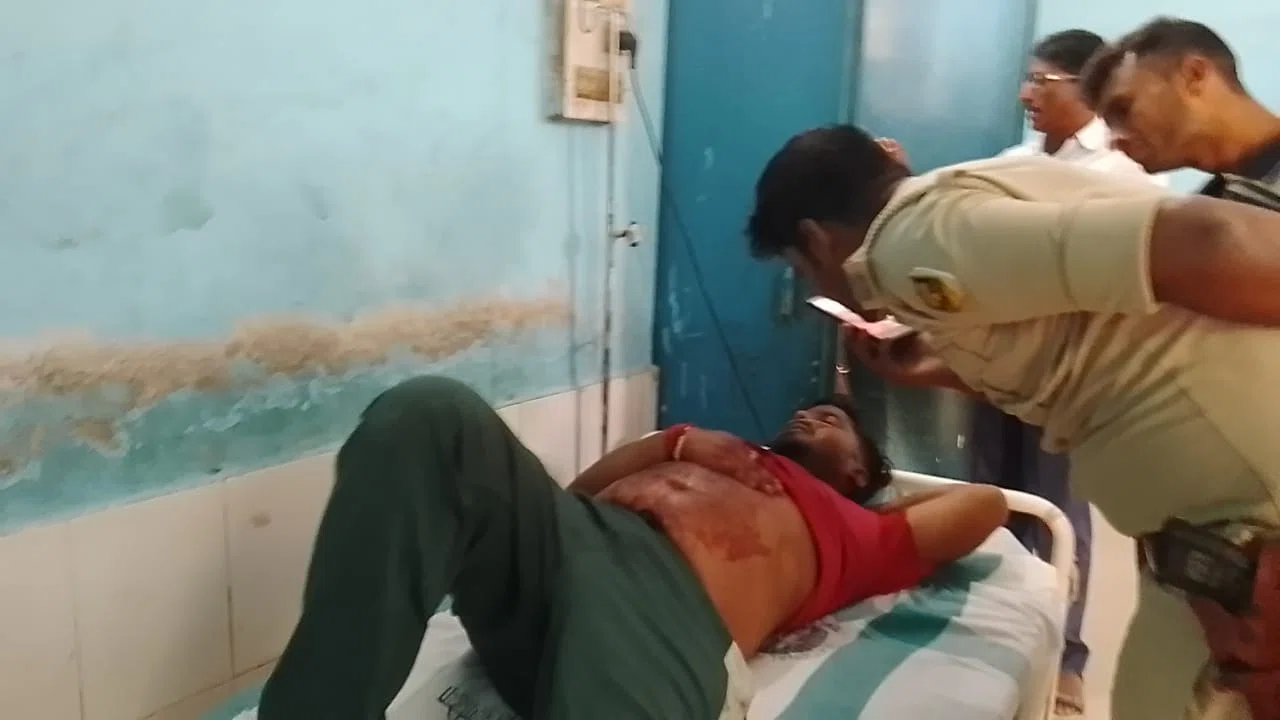 जमीनी विवाद को लेकर चली दर्जनों चक्र गोलियां, गोली लगने से एक युवक जख्मी, रेफर